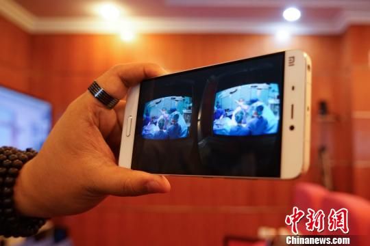 家首次VR直播小儿活体肝移植手术 降低学习门