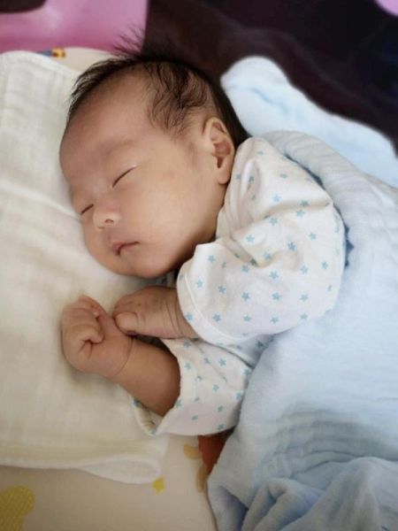 破除"巨人"早逝魔咒 罕见阻断马凡综合征试管婴儿满月